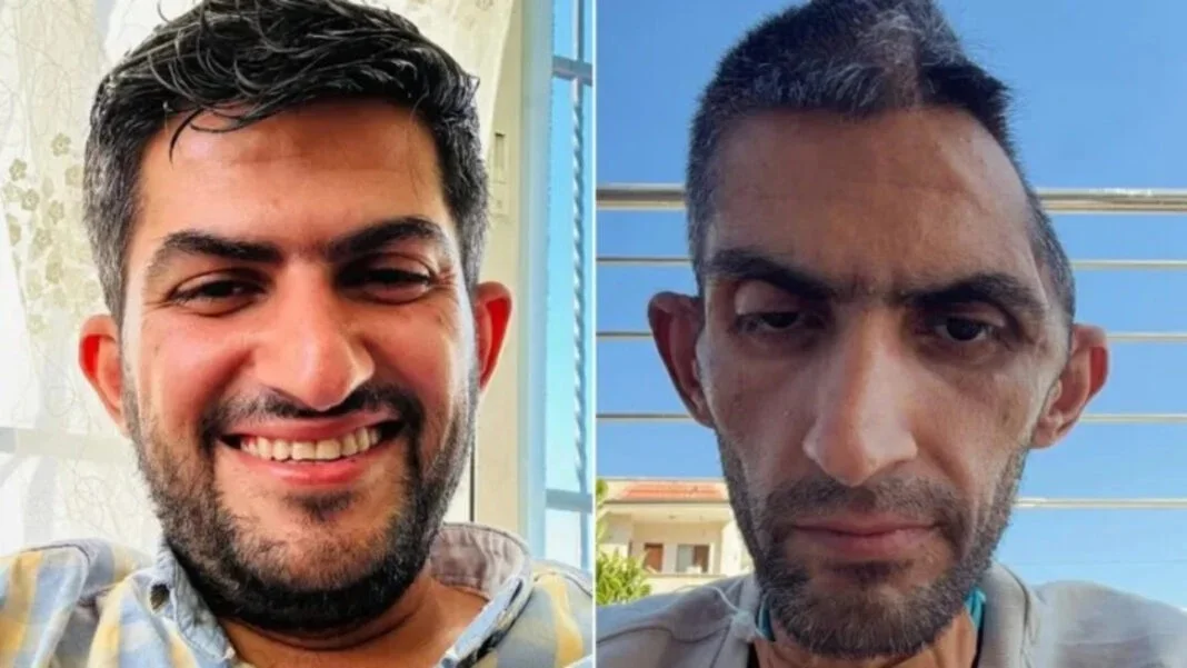 ইসরায়েলি কারাগারে নির্যাতনে ফিলিস্তিনি সাংবাদিকের করুণ অবস্থা