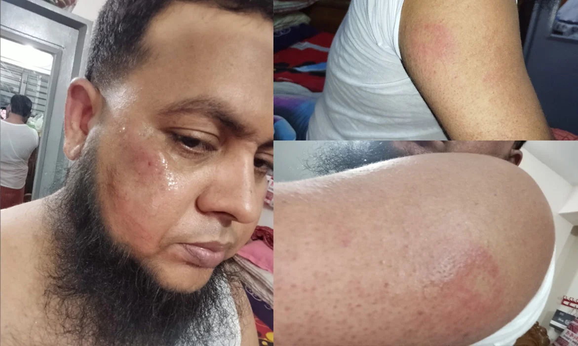 বিকেএমের জাজিরা উপজেলা সাধারণ সম্পাদকের ওপর বিএনপির সশস্ত্র হামলা